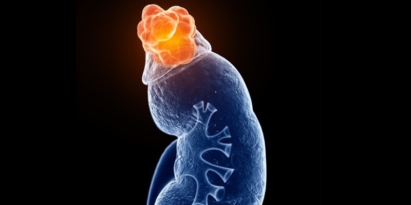 Suprarrenal